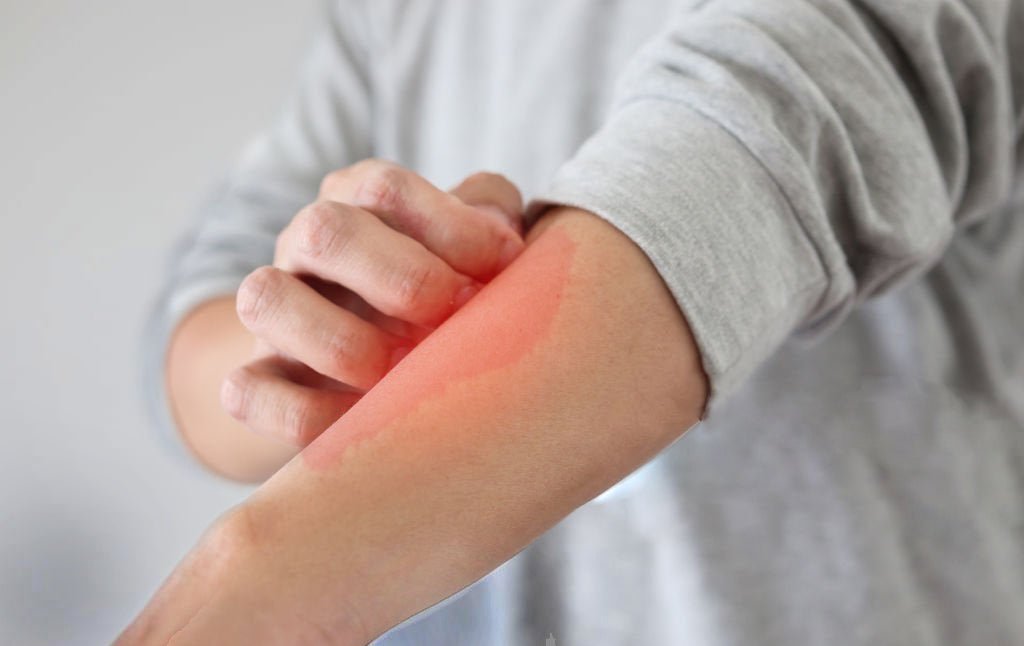 Nichel tested: informazione e consapevolezza - ZiaCris DispensAttiva